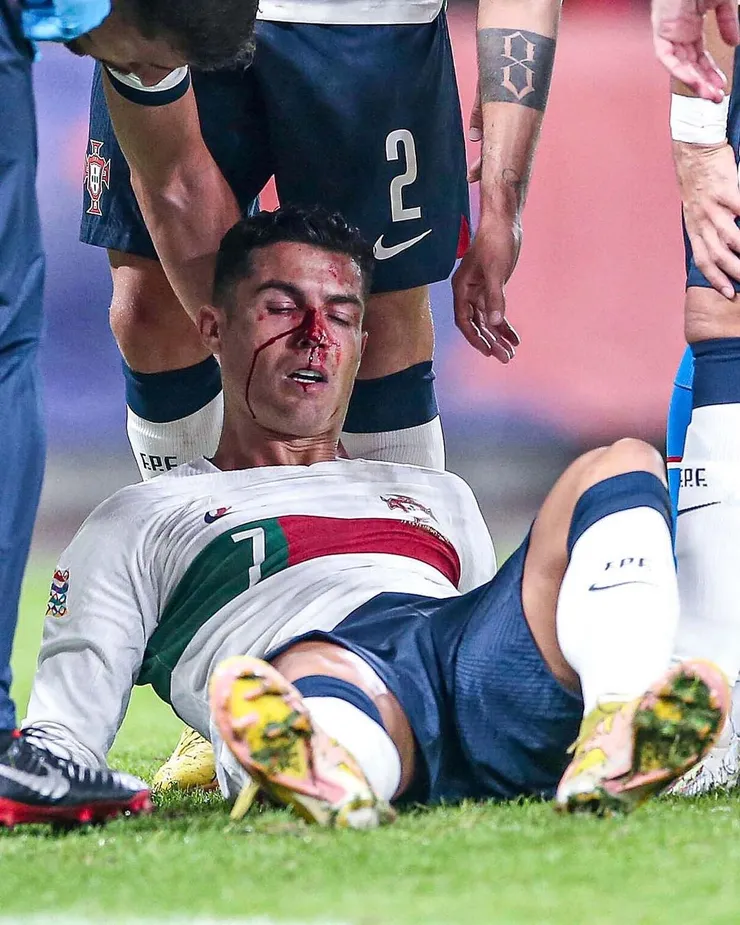 ronaldo-blood.jpg