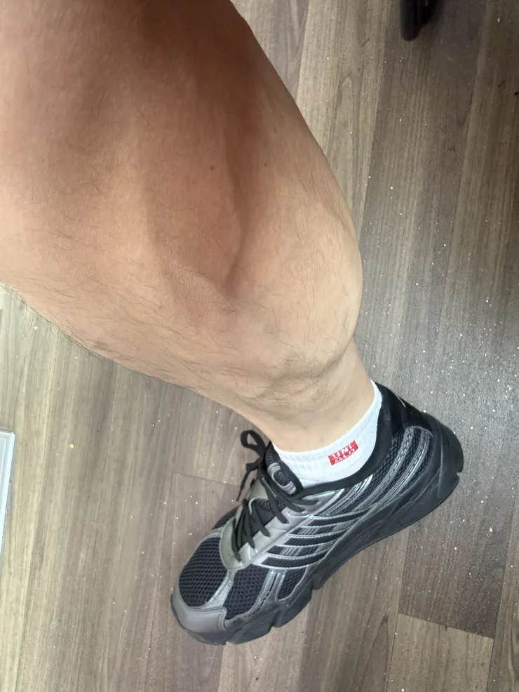 이게하지정맥증상인지 걱정되네요 이미지 1